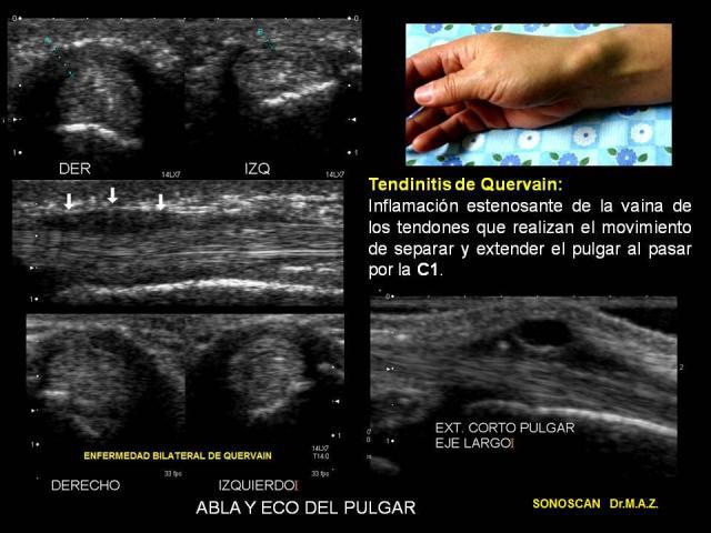 Casos | Sonoscan